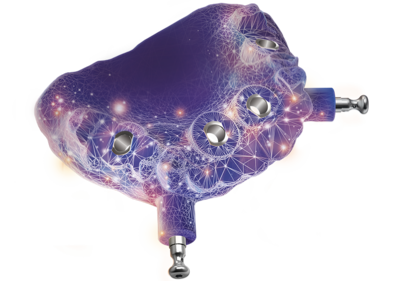 Exoplan osnovna verzija